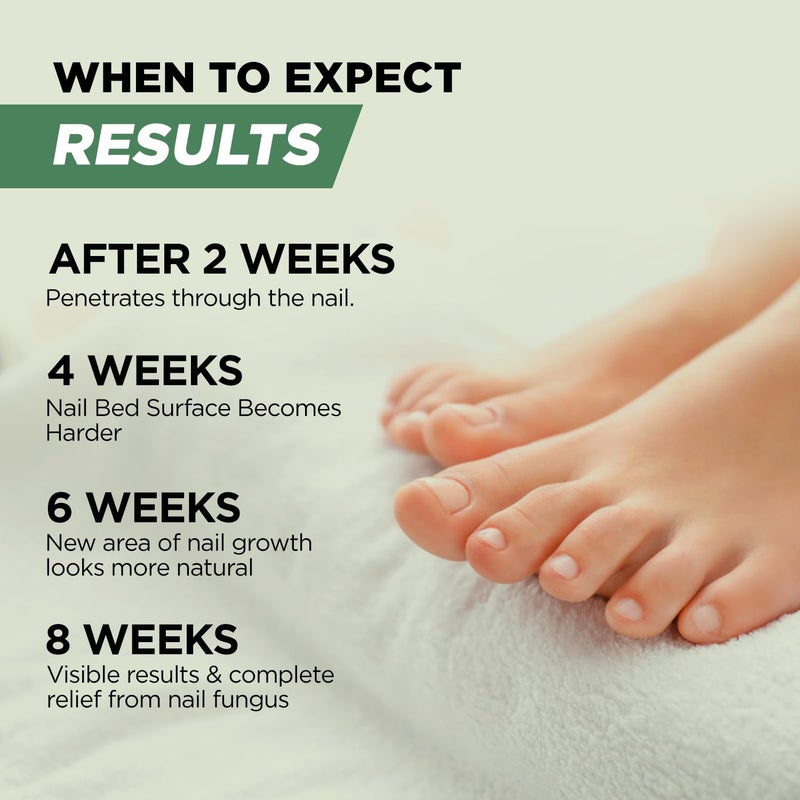 Foot Cure Toenail Renewal Solution Extra Strength Care for Toe Nail & Fingernails - Nail Repair Solution for broken, Discolored Nails - Renews Damaged Cracked Ingrown Toenail Made In USA 0.50 Fl Oz - 2 Pack - Image 5