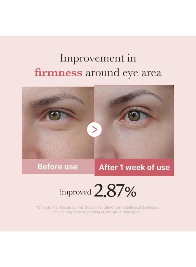 مصل العين ببتيد وردي مستخلص الحمض النووي لسمك السلمون من ميديكوب، يحتوي على النياسيناميد و 99٪ 1.01 أونصة سائلة (3.01 مل) - Image 4