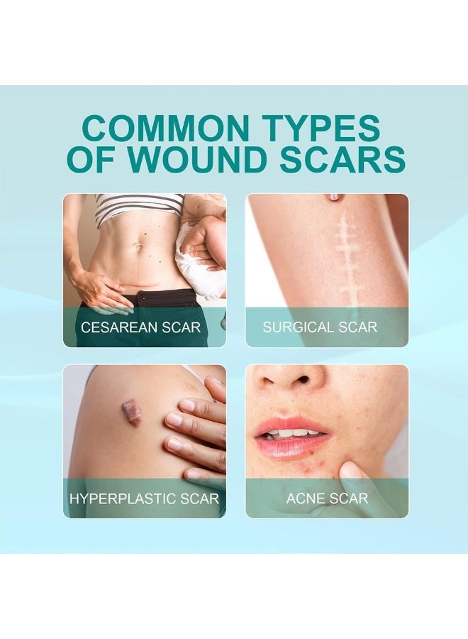 SOUTH MOON Medical Grade Scar Spray, Reduce Scars and Smooth Skin 20g - Image 5