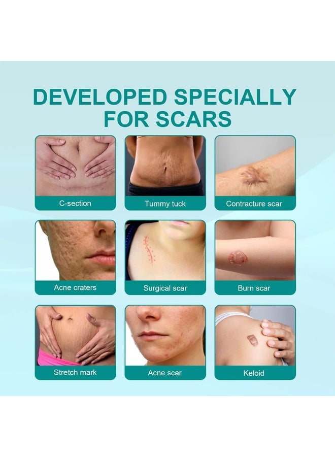 SOUTH MOON Medical Grade Scar Spray, Reduce Scars and Smooth Skin 20g - Image 4