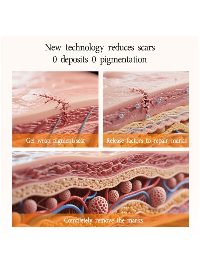 LYDIMOON Scar Repair Gel | For Surgical, Burn, Acne Scars, Gentle Fade Repair 20g - Image 5