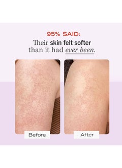 First Aid Beauty Kp Bump Eraser Exfoliating Body Scrub – Exfoliator For Bumps + Chicken Skin From Keratosis Pilaris With 10% Aha (Glycolic + Lactic Acids) – 56.7 G  - Image 3