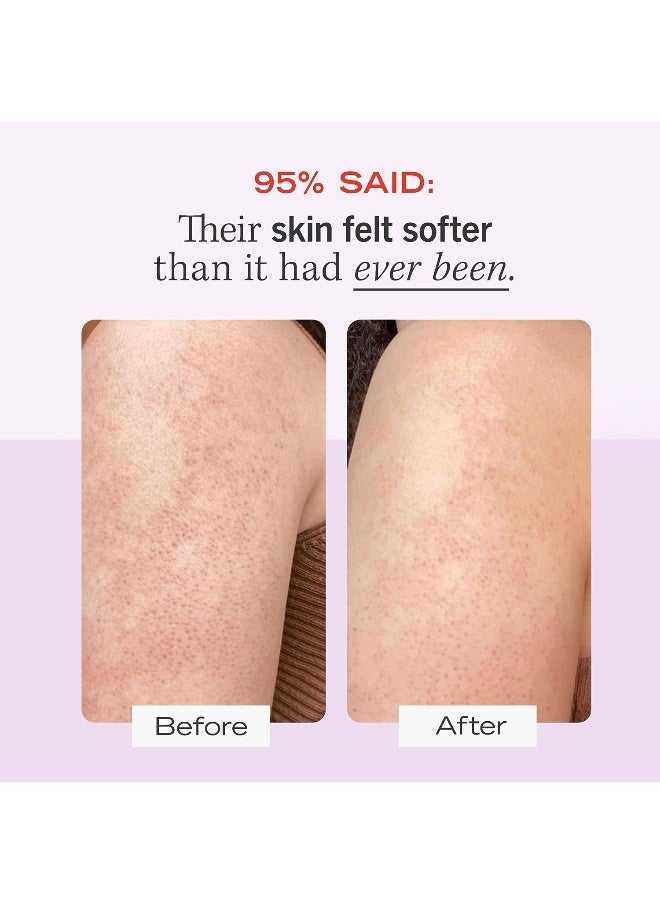 First Aid Beauty - Kp Bump Eraser Exfoliating Body Scrub – Exfoliator For Bumps + Chicken Skin From Keratosis Pilaris With 10% Aha (Glycolic + Lactic Acids) – 56.7 G - Image 1