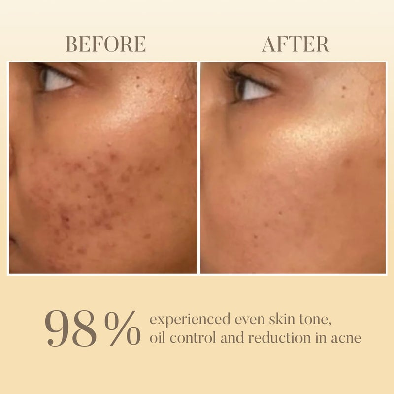 Ohria Ayurveda Neem Tulsi Face Wash - Image 5
