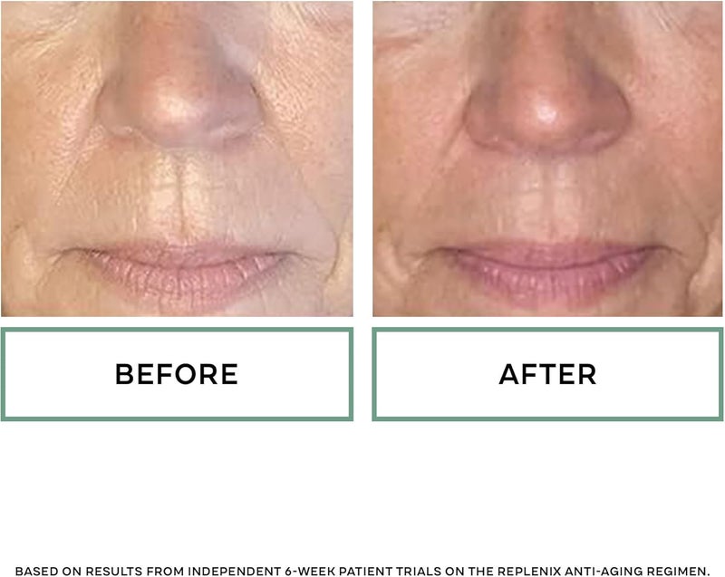 Replenix Glycolix Elite Glycolic Acid 20% Resurfacing Cream with Vitamins A, C, E - Dark Spot Corrector and Pore Reducer, 1.7 oz - Image 5