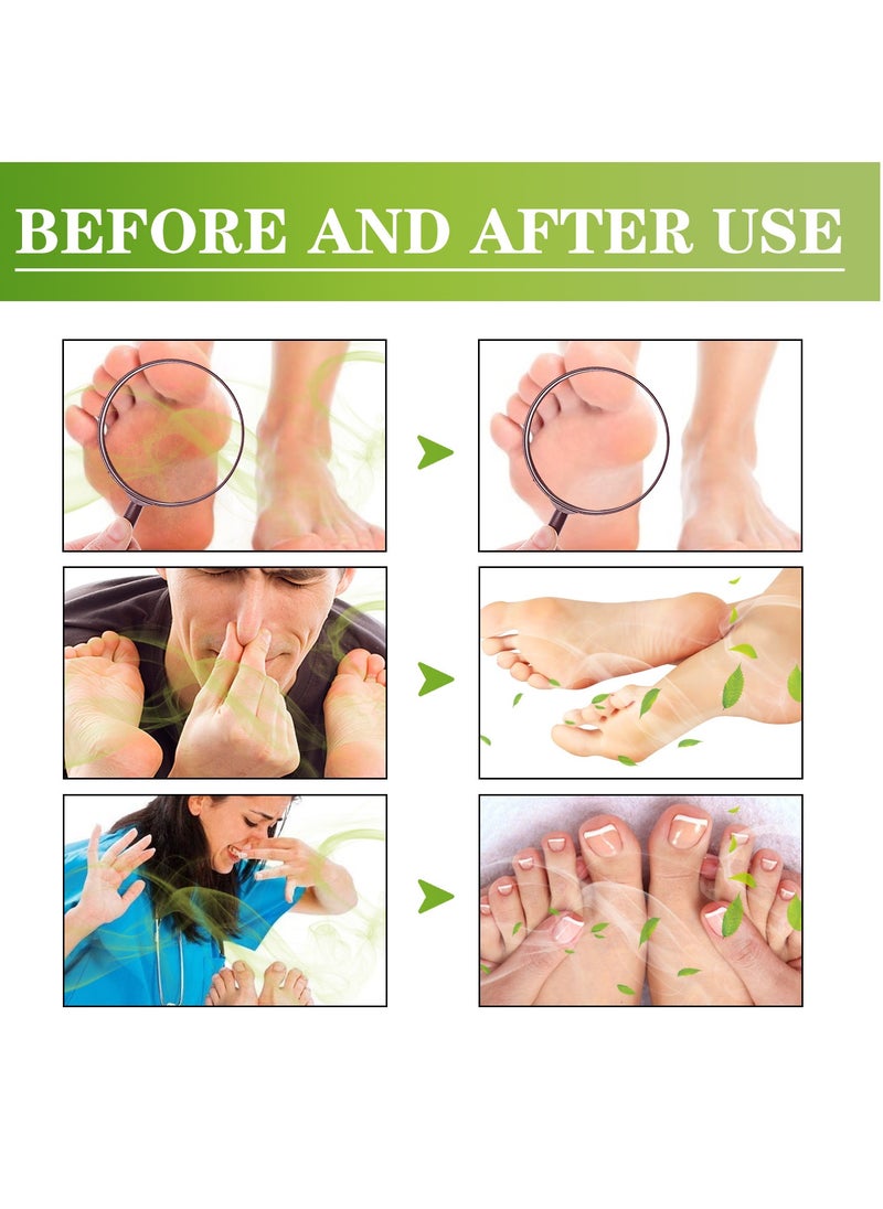 SOUTH MOON - Sweaty Feet Foot Spray, Foot Spray, Anti Sweat Spray, Foot Spray Odor Eliminators Spray, Effectively Eliminate Foot Odor, Anti Foot Odor Fast Deodorization 30ml - Image 1