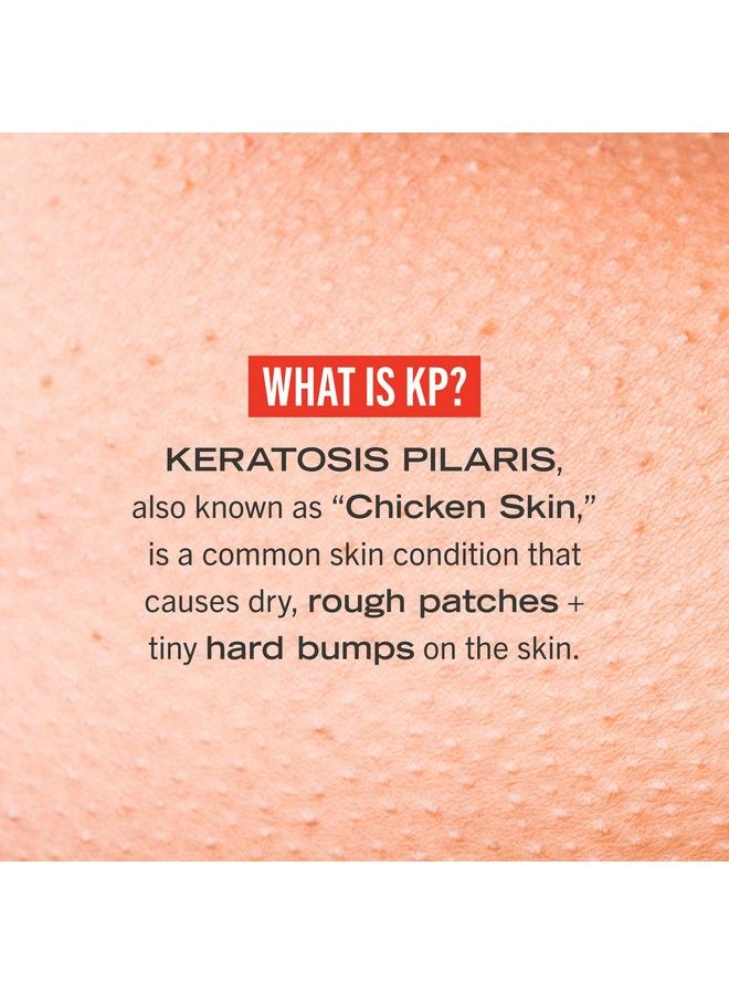 First Aid Beauty مقشر الجسم KP Bump Eraser لعلاج التهاب الجلد الجريبي مع 10% من حمض ألفا هيدروكسي 2 أونصة. - Image 4