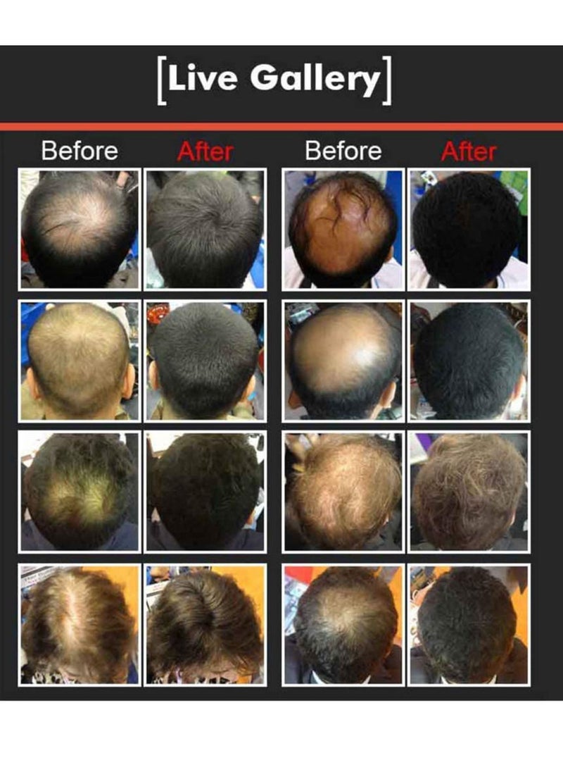 Dexe - Hair Building Fibers Makes Thin Hair Thick Everyday Black 22 grams - Image 1