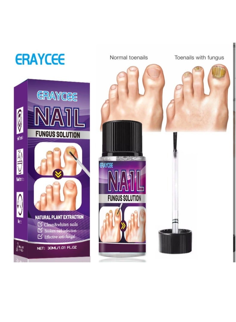 ERAYCEE Fungal Nail Treatment Liquid Nail Fungus Treatment for Toenails & Fingernails Fungal Nail Renewal Anti Fungus Nail Repair Smooth & Hydrates Nail Reduce Discoloration 30ml - Image 1
