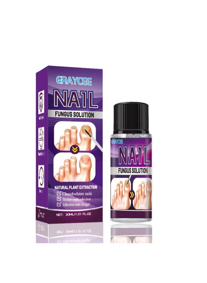ERAYCEE Fungal Nail Treatment Liquid Nail Fungus Treatment for Toenails & Fingernails Fungal Nail Renewal Anti Fungus Nail Repair Smooth & Hydrates Nail Reduce Discoloration 30ml - Image 5