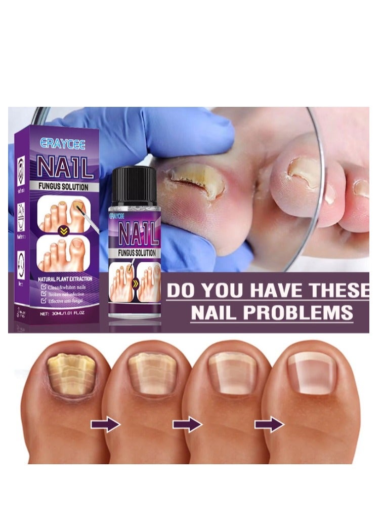 ERAYCEE Fungal Nail Treatment Liquid Nail Fungus Treatment for Toenails & Fingernails Fungal Nail Renewal Anti Fungus Nail Repair Smooth & Hydrates Nail Reduce Discoloration 30ml - Image 3