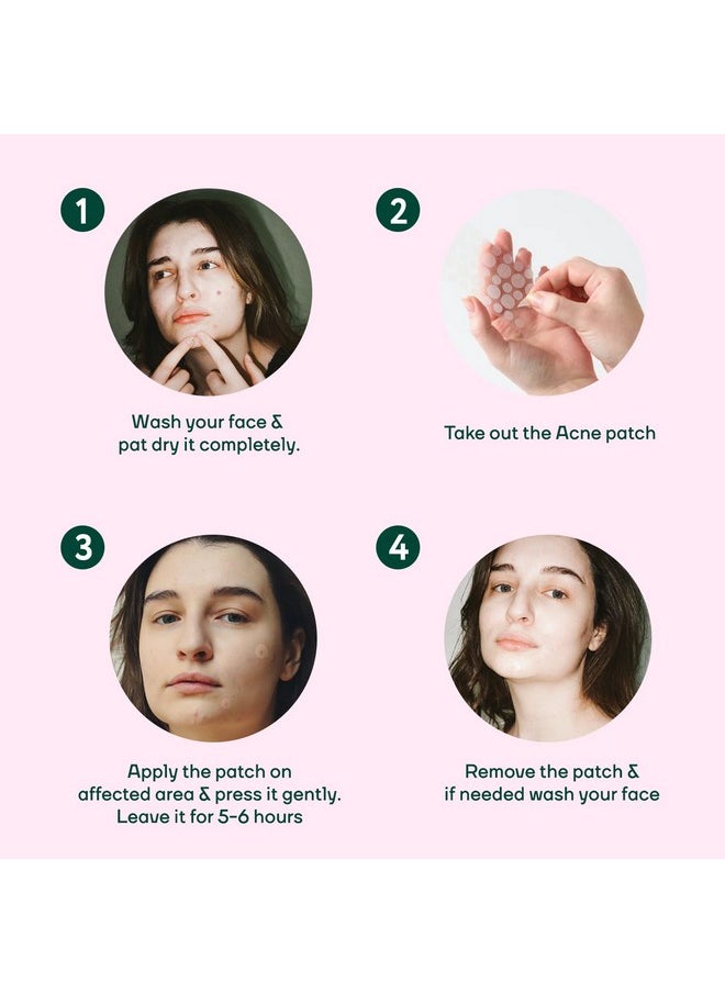 Mountainor - ® Acne Pimple Patch - Hydrocolloid + Tea Tree Oil Potent Spot Cover, Fast Breakout Healing, Overnight Removal Of Acne Gunk, Waterproof Invisible Patches, Safe & Certified 36 Patches. - Image 1