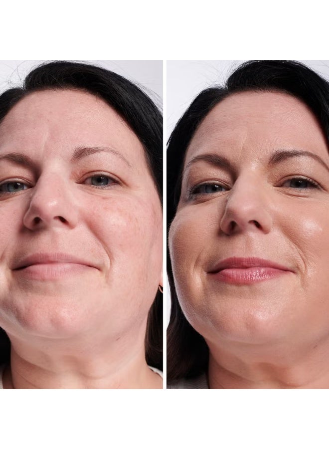 آي كوزمتيكس خافي عيوب البقع الداكنة من آي تي ​​كوزماتيكس - لايت كول 20 - Image 2