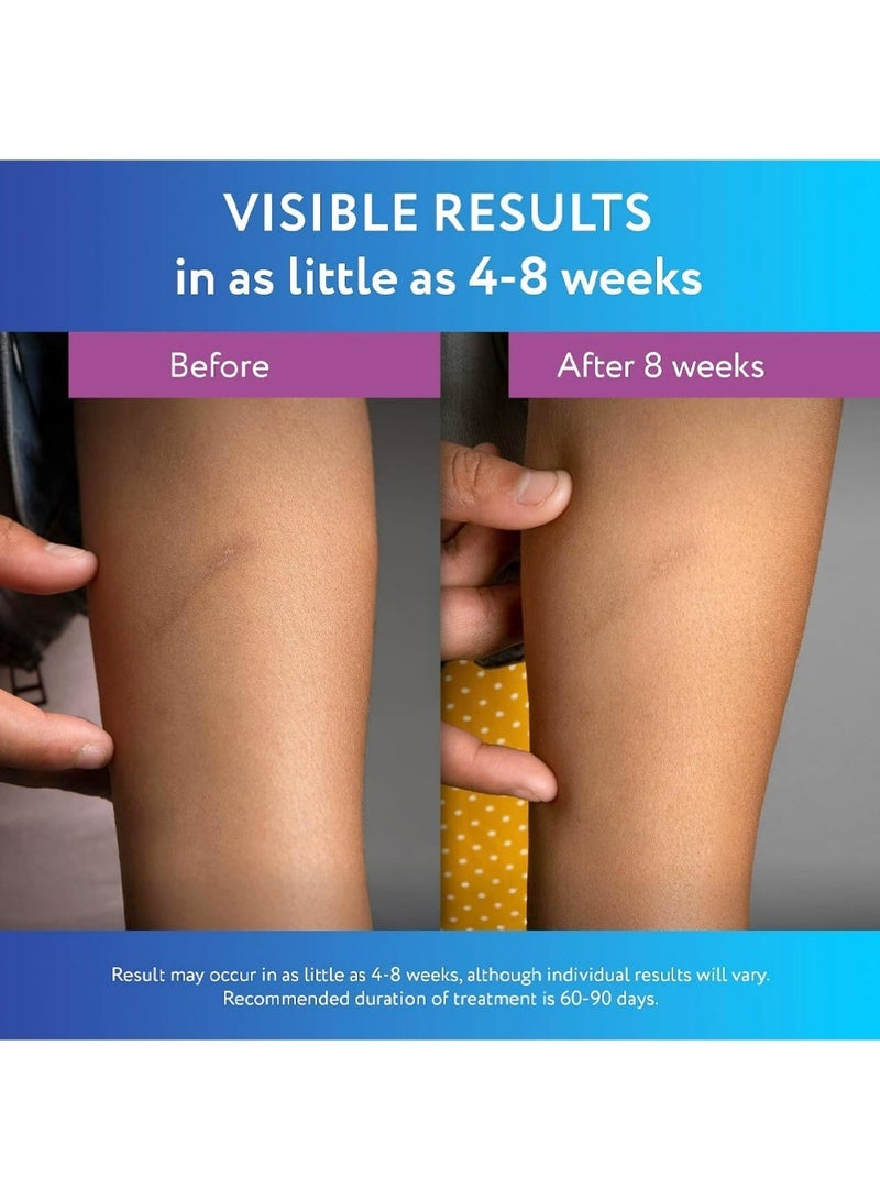 scaraway 2Pcs Silicone Scar Gel, Helps Improve Size, Color & Texture of Hypertrophic & Keloid Scars from Injury, Burns & Surgery, Water Resistant - Image 4