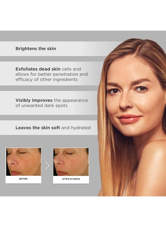 Glytone - Glytone Enhance Brightening Complex - With 12% Azelaic Acid, 3% Glycolic Acid - Brightens Skin & Reduces Dark Spots - Non-Comedogenic - 1 fl. oz. - Image 1