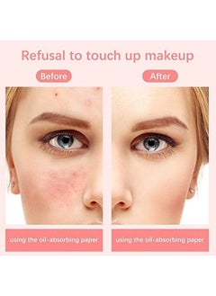 WIDEWINGS Oilabsorbing Volcanic Stone Face Roller Reusable Facial Skincare Tool Oil Control Roller For Oily Skin Care Oilabsorbing Face Roller With Makeup Sponge To Remove Excess Shine  - Image 3