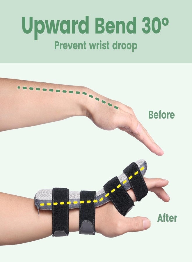 DrFinger جبيرة شلل العصب الكعبري لعلاج تدلي الرسغ، دعامة تثبيت ثابتة قابلة للتعديل للأصابع، لعلاج شلل العكاز، وضعف الأصابع، وجراحة استبدال مفصل الرسغ المشطي السلامي، والتعافي من السكتة الدماغية - تناسب اليد اليمنى واليسرى - Image 2