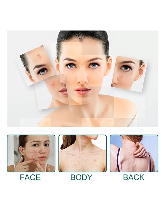 BUPY Colorful Acne Patch ,Star Shaped Hydrocolloid Acne Patches  Spot Dots Stickers for Blemishes Pimples and Whiteheads-1 Pack 112 Patches  - Image 3