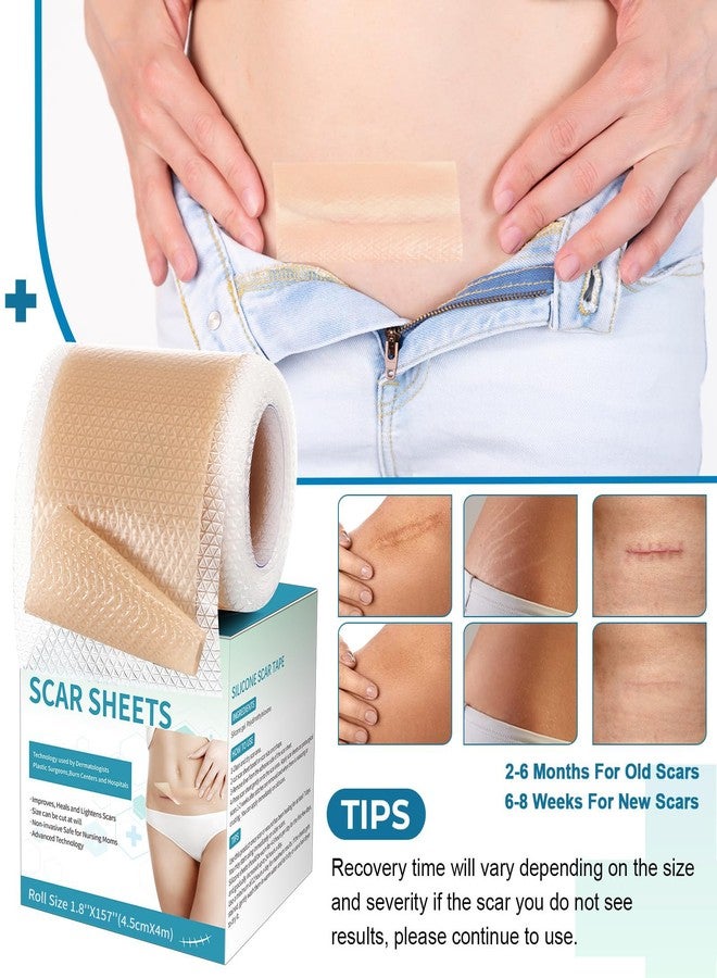 Rvlaim Silicone Scar Sheets, Silicone Scar Tape(1.8”x 157” Roll-4M), Silicone Scar Strips, Professional Scar Removal Sheets for Surgical Scars, Keloid, C-Section, Burn et - Image 5