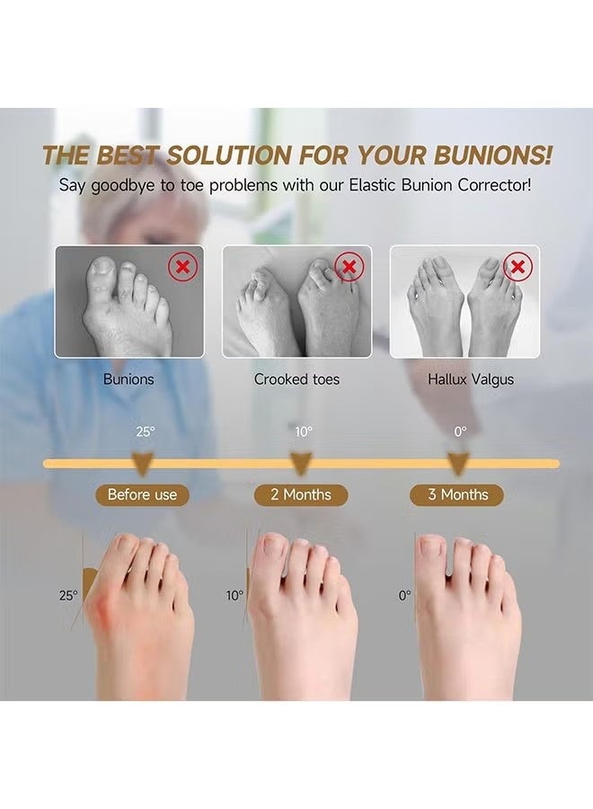 1 Pair Bunion Corrector Relief Sleeve for Women & Men, Big Toe Gel Bunion Corrector Separator Straightener for Day/Night Support, Hallux Valgus Pain Relief, Bunion Socks - Image 5