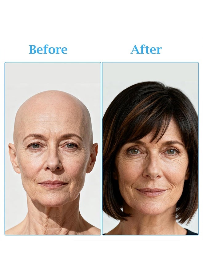 10 أوراق من شرائط لاصقة للشعر المستعار من الدانتيل، مقاومة للماء، مزدوجة الجوانب، مع ثقوب - قماش مطاطي للشعر المستعار ذو قوة تثبيت فائقة - شريط لاصق أزرق للشعر المستعار، جيد التهوية، مناسب للرجال والنساء - Image 5