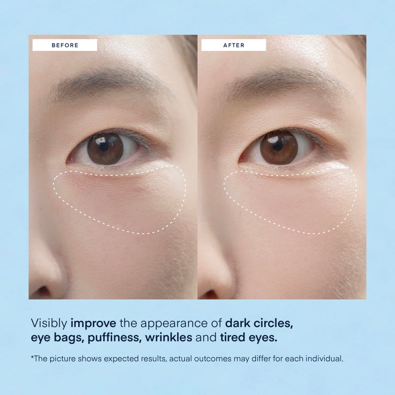TEREZ & HONOR Under Eye Patches for Dark Circles - 60 Korean Hydrogel Masks for Puffiness, Bags with Caffeine, Hyaluronic Acid, Niacinamide - Undereye Brightening, Hydrating, Anti-Wrinkle & Cooling - Image 4