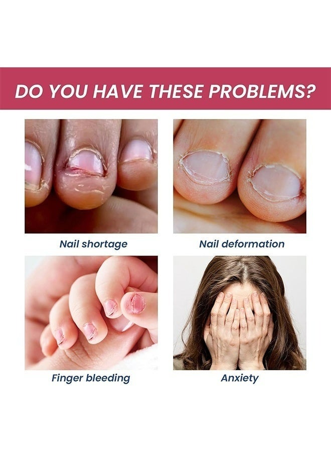Lanthome 15ml Anti Nail Biting Polish Clear Varnish With Plant Extracts To Discourage Nail Biting Thumb Sucking For Kids And Adults Daily Use - Image 2