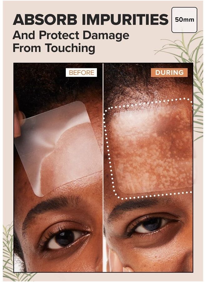 I DEW CARE - Hydrocolloid Acne Pimple Patch - Timeout Blemish Wide | Korean zit dark spot patches for face and skin, big large size, 6 Count (50 x 50mm), Pus absorbing with Tea Tree Oil - Image 1