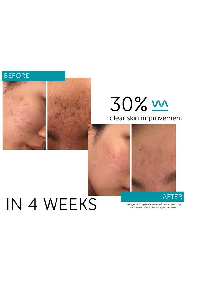 فاكتور فايڤ مصل متجدد مع عوامل نمو الخلايا الجذعية Hgf لشد البشرة وتنعيم التجاعيد وتقليل المسام وتجديد الشباب، حجم السفر 0.34 أونصة سائلة/10 مل - Image 4