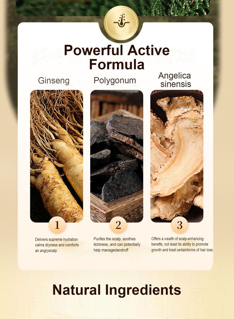 Splendors 500ml Against Dandruff Nourishing Shampoo Oil Control Shampoo Stop Itchiness Shampoo Easy To Clean Strengthen Hair Against Hair-loss Shampoo For All Hair Types For Men Women Adult - Image 3