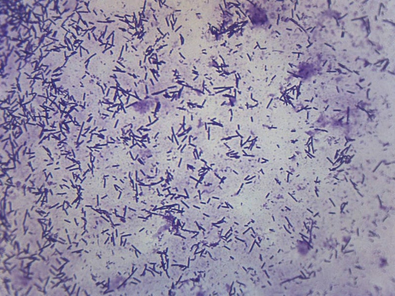 EISCO Escherichia Coli Smear, Gram Stain - Prepared Microscope Slide - 75 x 25mm - Biology & Microscopy - Image 1