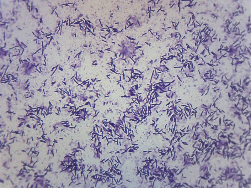 EISCO Escherichia Coli Smear, Gram Stain - Prepared Microscope Slide - 75 x 25mm - Biology & Microscopy - Image 2