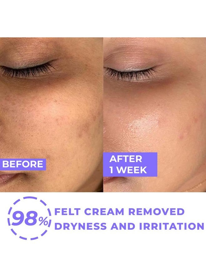 Light Up Beauty Wave Hydrating Day Cream With 5% Squalane & 2% Niacinamide For Healthy Hydrated Skin Reduce Pores & Dark Spots 72 Hours Hydration Repair Damaged Skin 50G - Image 2