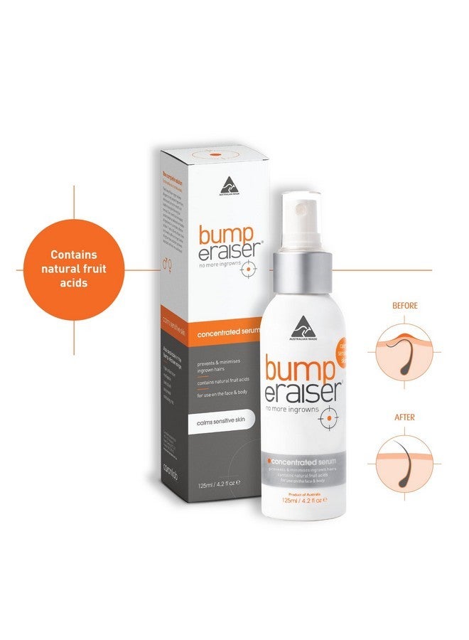 Bump Eraiser Concentrated Ingrown Hair Serum 4.2 fl oz for Ingrown Hair Treatment, Razor Burns and Razor Bumps - Image 3