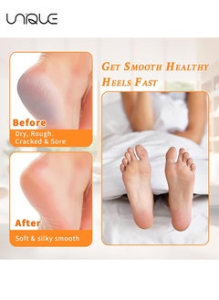 Unique Cracked Heel Treatment Repair Socks - 2 Pair of Premium Padded Compression Gel Sleeve/Sock for Dry Feet Treatment - Spa Moisturizing Heel Socks for Repairing (One Size fits Most)  - Image 3