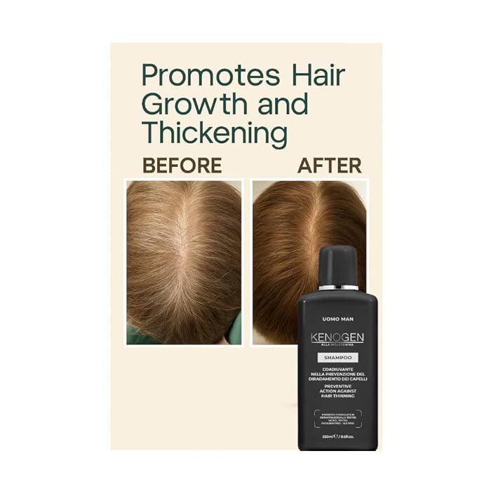 Kenogen Men’s Thinning Hair Shampoo – Helps Hair Look Thicker & Fuller – Melatonin + DHT Support – Made in Italy - Image 5