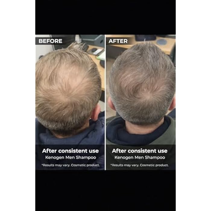 Kenogen Men’s Thinning Hair Shampoo – Helps Hair Look Thicker & Fuller – Melatonin + DHT Support – Made in Italy - Image 2