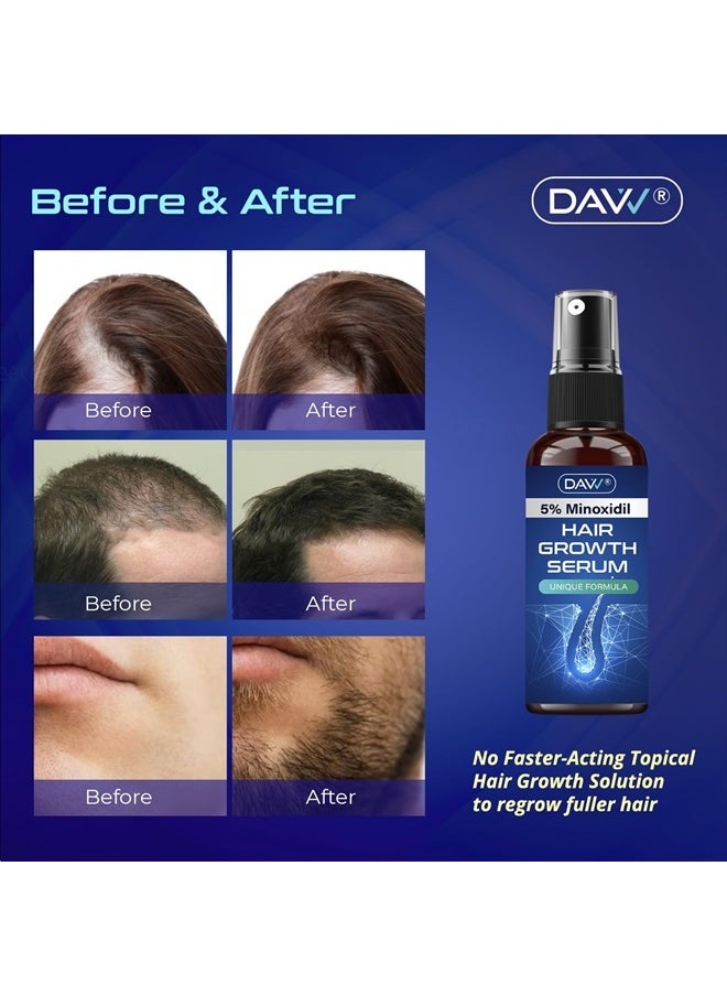 DAVV - 5% Minoxidil Hair Growth Serum For Men And With Biotin Hair Regrowth Treatment For Stronger Thicker Longer Hair help to Stop Thinning and loss hair 60 ML - Image 1
