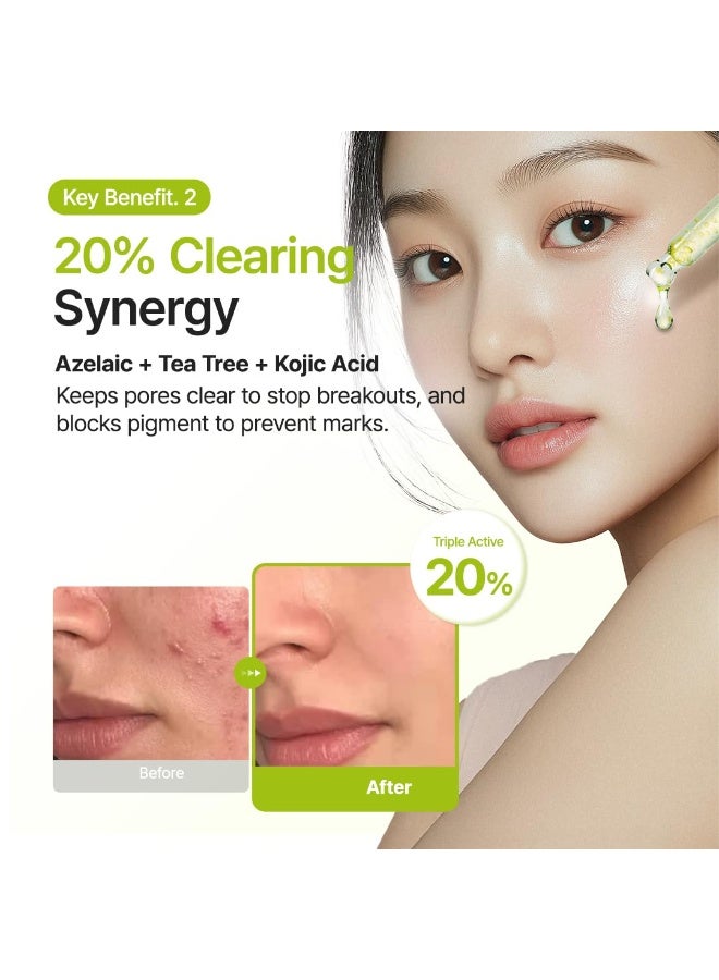 Purito SEOUL Azelaic Acid 10 Kojic Azulene Serum 30ml - Image 5