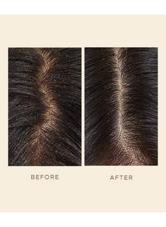 VEGAMOUR VEGAMOUR GRO Scalp Detoxifying Serum, Scalp Serum with Zinc PCA Removes Buildup & Soothes Scalp, Natural Citrus Scent, 2 fl. oz.  - Image 5