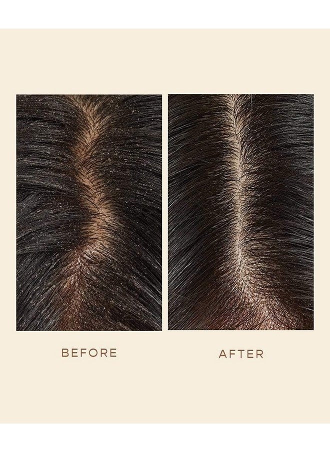 VEGAMOUR - VEGAMOUR GRO Scalp Detoxifying Serum, Scalp Serum with Zinc PCA Removes Buildup & Soothes Scalp, Natural Citrus Scent, 2 fl. oz. - Image 1