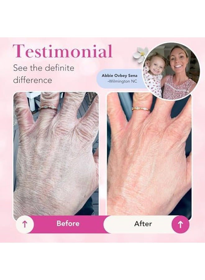 Theraplex Clear Emollient Lotion for Chronic Dry Skin Conditions(Psoriasis, Eczema, Xerosis and Ichthyosis) Dermatologist Recommended 8 oz - Image 4