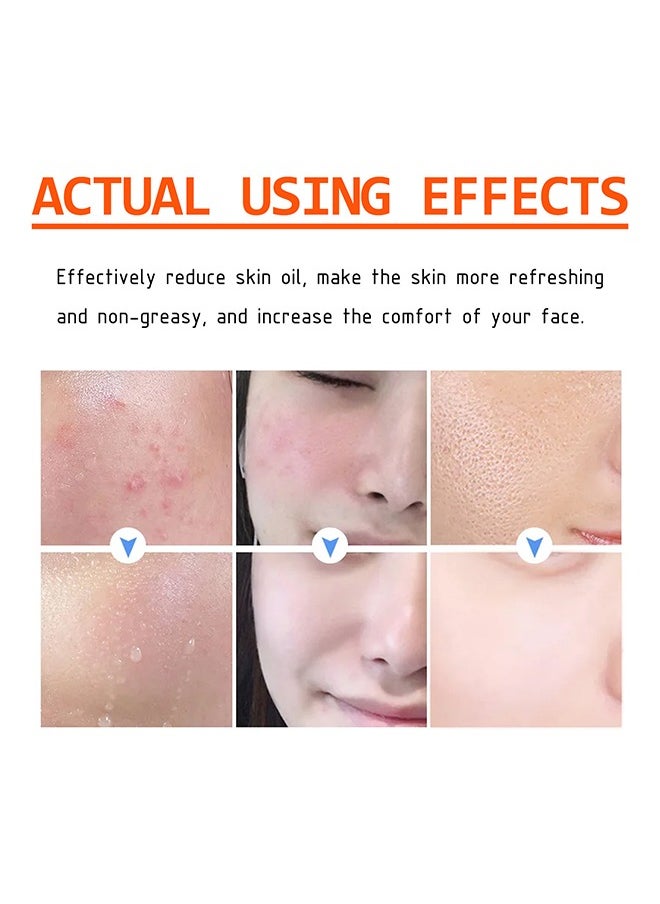 West&Month Acne Face Cream, Acne Spot Treatment for Face & Acne Dots, Natural Cystic Acne Treatment, For All Skin Types, Premium Acne Scar Cream & Pimple Remover 100g  - Image 2