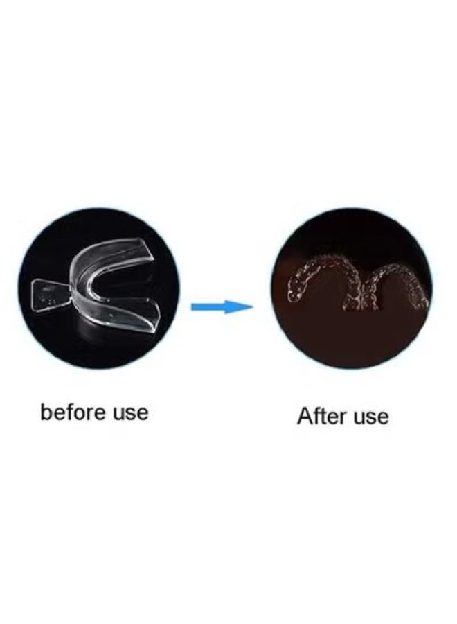 JS 4pcs Mouth Guard for Grinding Teeth, Moldable Dental Night Guard and Clenching Teeth Bruxism, Dental Guard at Home Kit ,Prevent Grinding of Teethbraces - Image 5