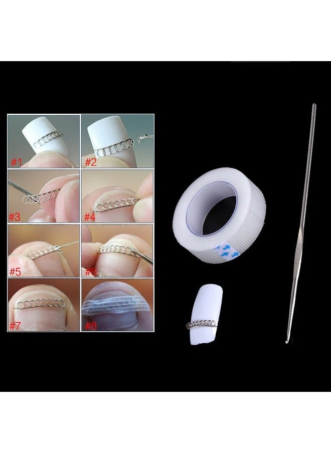 YOSOO - Ingrown Nail Corrector,Professional Ingrown Toe Nail Correction Kit Pedicure Toes Treatment Tools Set For Paronychia (Sticker+Wire+ Crochet Hook) - Image 1