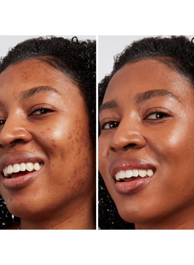 آي كوزمتيكس خافي عيوب البقع الداكنة من آي تي ​​كوزماتيكس - ريتش كول 50 - Image 2