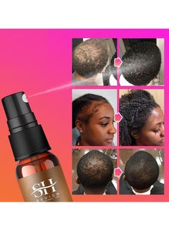 Sevich Naturals Chebe Hair Growth Spray 100% African Chebe Essence Thin Loss Hair Treatment Moisture &Repair Damaged Hair Root Scalp Skin Refresh Daily Use Hair Growth Treatment Liquid 30ml  - Image 3