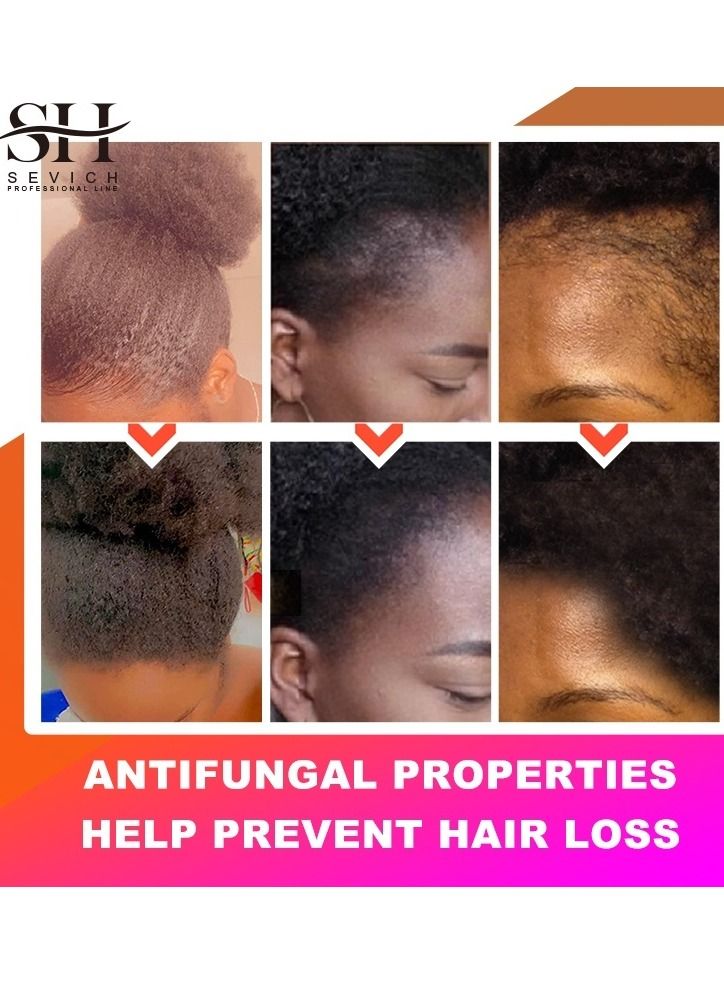 Sevich Naturals Chebe Hair Growth Spray 100% African Chebe Essence Thin Loss Hair Treatment Moisture &Repair Damaged Hair Root Scalp Skin Refresh Daily Use Hair Growth Treatment Liquid 30ml - Image 4