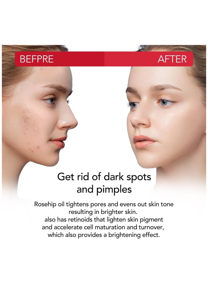 ALIVER Rosehip Oil 60ml, 100% Pure Rosehip seed Oil for Face with Vitamin C, Cold Pressed Rose hip Oil Organic for Stretch Marks,Hair,Skin,Fine Lines & Wrinkles - Image 5