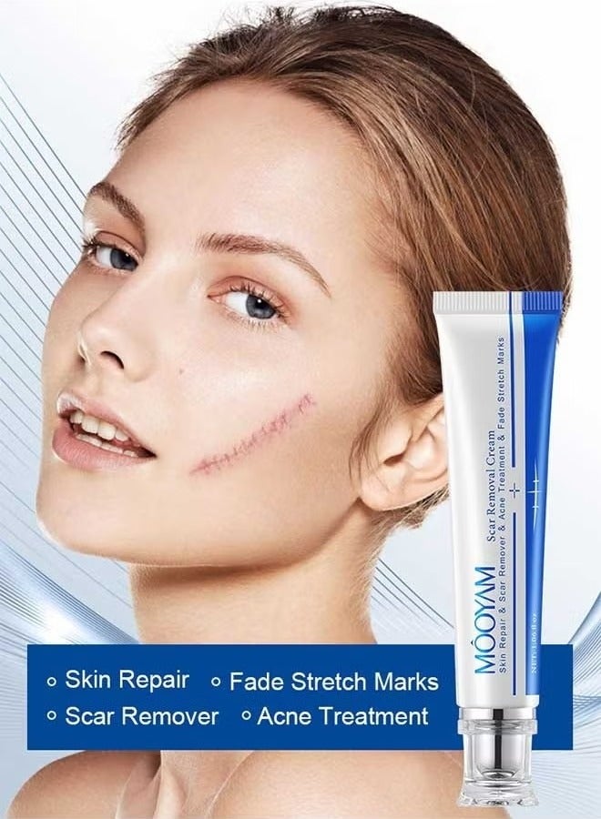 MOOYAM Scar Removal Cream, Skin Repairing Cream Fade Scars/Stretch Marks/Acne Treatment, Improve Scar Skin, Deeply Moisturizes Skin - Image 1